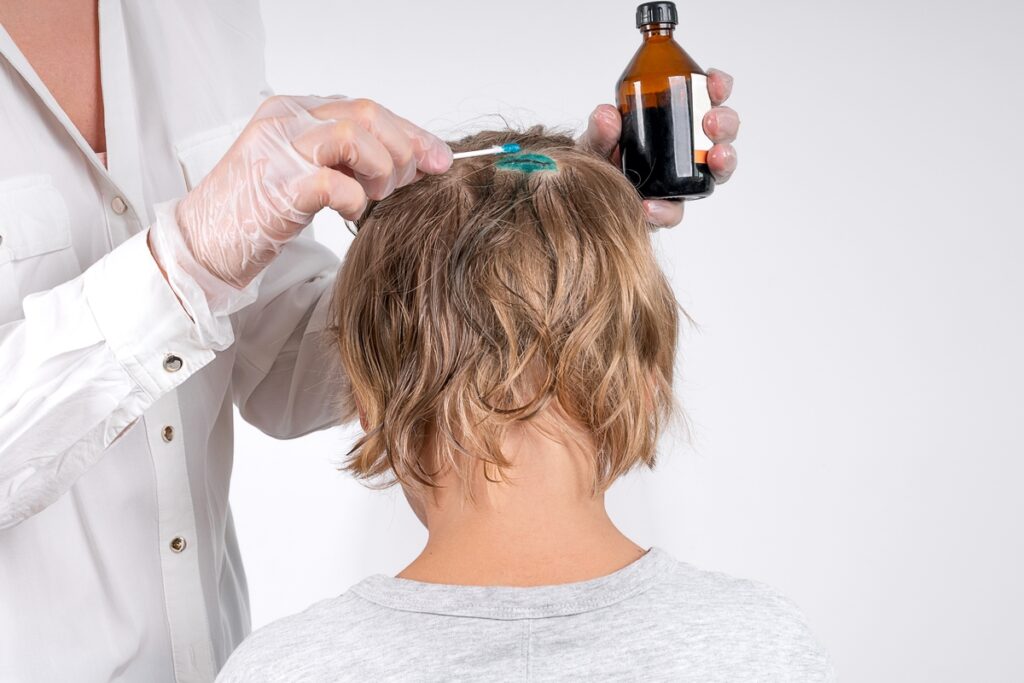 мальчику мажут голову зеленкой 