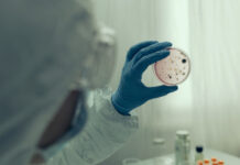 Эксперт Гемотест Демьяновская рассматривает контроль холеры Vibrio cholerae ekspert gemotest demyanovskaya rassmatrivaet kontrol holery -urbandigest-ru-174583221700-0