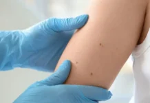 Дэниел Сугай рассказал, как распознать ранние признаки рака кожи deniel sugaj rasskazal kak raspoznat rannie priznaki raka kozhi-urbandigest-ru-174860615300-0