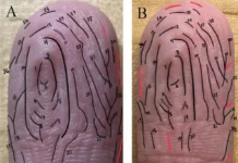 Открытие Бингемтонского университета о влиянии срединного нерва на морщины otkrytie bingemtonskogo universiteta o vliyanii sredinnogo nerva na morshhiny-urbandigest-ru-174711719100-0