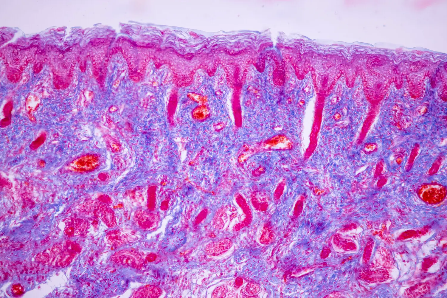 Стволовые клетки долгожителей от Матеуса Видигала де Кастро раскрывают секреты старения после COVID-19-0