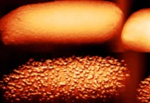 kak antibiotikipolimiksiny uspeshno razrushayut zashhitu -urbandigest-ru-0