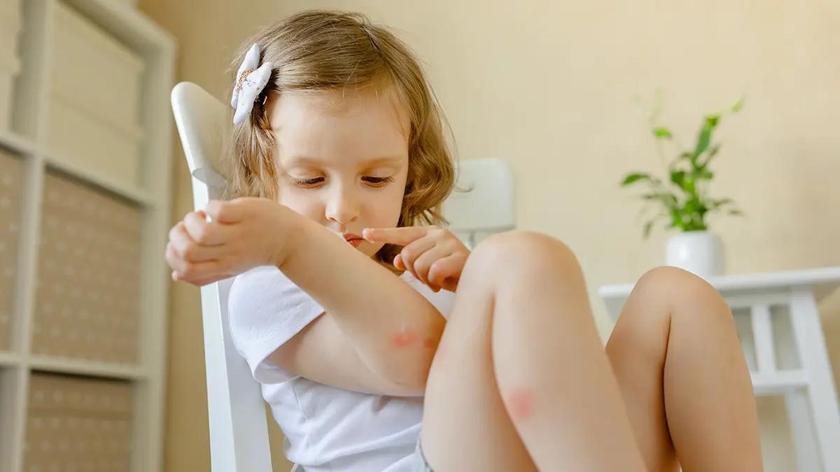 Россияне пожаловались на появление укусов после посещения пляжей Вьетнама