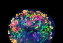 Доктор Нурия Монтсеррат и доктор Елена Гаретта создали гибридную почку doktor nuriya montserrat i doktor elena garetta sozdali gibridnuyu pochku-urbandigest-ru-0