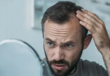 Современные методы лечения алопеции: предупреждаем выпадение волос sovremennye metody lecheniya alopeczii preduprezhdaem vypadenie volos-urbandigest-ru-0