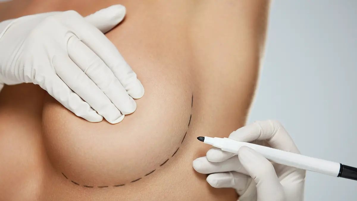 В ряде регионов России маткапитал можно потратить на маммопластику