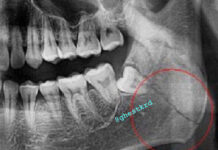 Конфликт из-за сигареты привел к серьезным последствиям в Краснодарском крае d31e5fa1-59d9-46e5-98fa-7846282edf3d-67a40248