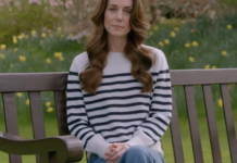 Кейт Миддлтон и слухи о пластической операции в 2024: экспертное мнение хирурга 1a75c018-f9dc-4cb5-a775-ff2ecd5edfd6-67ce11b0