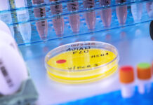 В США выявлен первый случай птичьего гриппа H5N1 со смертельным исходом 3e94e926-cc7a-47b9-b557-1f5153db2401-67d01b0d