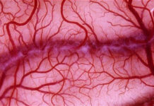 Новое исследование о влиянии кожных заболеваний на здоровье сосудов 54b181cb-182b-486b-a52c-1cb6b3c9467e-67d983dc