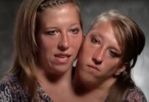 Срощенные сиамские близнецы Хенсел поделились радостной новостью c43b9073-de0d-4c94-a57d-6156f57ca08e-67c9facb