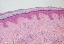 Полезные микроорганизмы для здоровья зубов, кожи и волос poleznye mikroorganizmy dlya zdorovya zubov kozhi i volos-news-blog-ru-174099326900-0