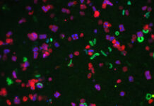 Прорыв в предсказании бактериального движения для медицинских инноваций от Института Флэтайрон proryv v predskazanii bakterialnogo dvizheniya dlya mediczinskih innovaczij ot instituta fletajron-news-blog-ru-174285353500-0