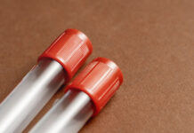 Мария Безрукова раскрыла три анализа «Будь Здоров» требуют голодания mariya bezrukova raskryla tri analiza bud zdorov trebuyut golodaniya-news-blog-ru-174496634200-0