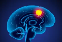 Анастасия Заворотнюк и современные подходы к борьбе с глиобластомой anastasiya zavorotnyuk i sovremennye podhody k borbe s glioblastomoj-news-blog-ru-174852340300-0