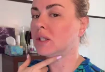 Анна Семенович поделилась результатами RF-лифтинга Morpheus в Instagram* anna semenovich podelilas rezultatami liftinga v -news-blog-ru-174712161400-0