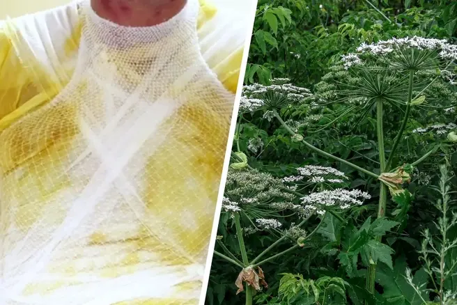 Сначала Алексей не обратил внимания на опасное растение | Источник: «Склиф» / T.me, Наталья Бурухина / NN.RU