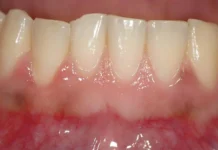 Настасья Кошелева и Сеченовский Университет представили прорыв в регенерации десен! nastasya kosheleva i sechenovskij universitet predstavili proryv v regeneraczii desen-news-blog-ru-0