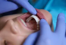 Александр Серяков рассказывает о симптомах рака полости рта и его ранней диагностике aleksandr seryakov rasskazyvaet o simptomah raka polosti rta i ego rannej diagnostike-news-blog-ru-0