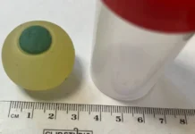 Удивительная история спасения школьника и опыт Морозовской больницы в Челябинске udivitelnaya istoriya spaseniya shkolnika i opyt morozovskoj bolniczy v chelyabinske-news-blog-ru-0