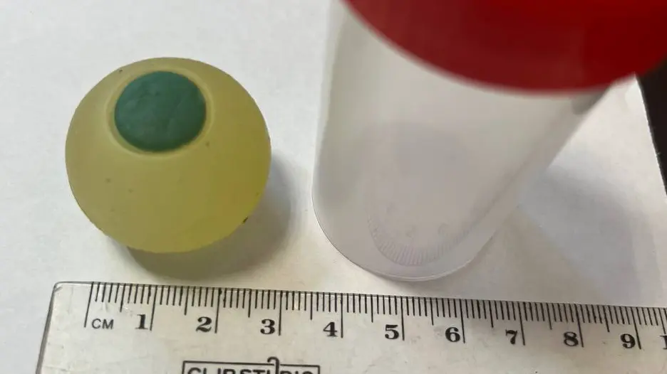 Школьник в Челябинске проглотил силиконовый глаз, перепутав его с мармеладом