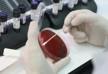 СПбПУ, Гамалеи и Шипиловских сделали прорыв в борьбе с меланомой spbpu gamalei i shipilovskih sdelali proryv v borbe s melanomoj-news-blog-ru-0