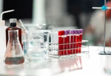 Экспресс-тест на ферритин и железо поможет выявить анемию Вводная картинка