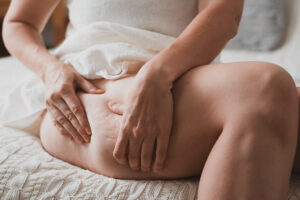 Close-up,Of,Female,Body,With,Cellulite,,Woman,Makes,Massage,Against