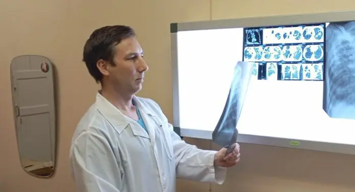 Областной клинический центр Екатеринбурга вернул здоровье пациентке с тяжелым туберкулезом-0