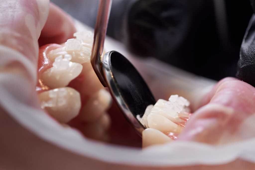 Стоматолог осматривает зубы пациента