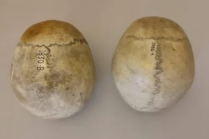 Иван Широбоков из Кунсткамеры создал новый подход в оценке возраста по черепу ivan shirobokov iz kunstkamery sozdal novyj podhod v oczenke vozrasta po cherepu-lessontime-ru-0