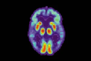Новаторские подходы к терапии Альцгеймера с использованием гликогена novatorskie podhody k terapii alczgejmera s ispolzovaniem glikogena-lessontime-ru-0