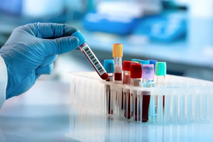 v universitete uejk forest vyyavleny biomarkery krovi dlya prognoza serdechnyh boleznej issledovannye richardom kazibve-lessontime-ru-0