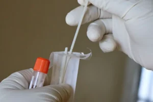 Новости о ситуации с оспой обезьян в Санкт-Петербурге и Подмосковье novosti o situaczii s ospoj obezyan v sanktpeterburge i podmoskove-lessontime-ru-0