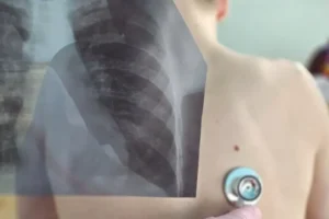 minzdrav rostovskoj oblasti o situaczii s tuberkulyozom v shkole nomer 61-lessontime-ru-0