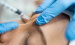 Пластический хирург раскрыл влияние ботокса на гармонию в отношениях 6167f470-ee12-4449-93d6-9277ae33b29f-68067319