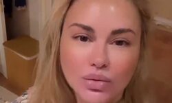 Анна Семенович делится вдохновляющими результатами преображения после пластической операции anna semenovich delitsya vdohnovlyayushhimi rezultatami preobrazheniya posle plasticheskoj operaczii-ul-rks-ru-174233901100-0