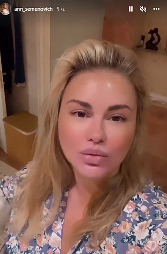 Анна Семенович делится вдохновляющими результатами преображения после пластической операции-0