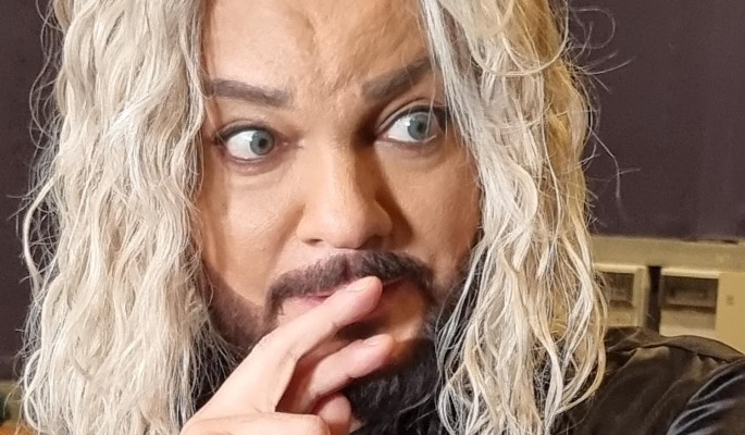 "Откачал или отрезал": Лисовец высказался об исхудавшем после пластики Киркорове