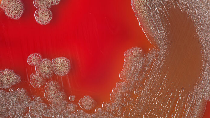 VibrioCholeraeBacterialColoniesOnBloodAgarPlateAbstractMedical