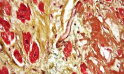 Сергей Шалаев и Семаглутид в борьбе за здоровое сердце и снижение веса sergej shalaev i semaglutid v borbe za zdorovoe serdcze i snizhenie vesa-ul-rks-ru-174426822300-0