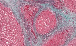 Сеченовский университет и Дмитрий Костюшев представляют инновации в диагностике гепатоцеллюлярного рака печени sechenovskij universitet i dmitrij kostyushev predstavlyayut innovaczii v diagnostike gepatoczellyulyarnogo raka pecheni-ul-rks-ru-174822986500-0