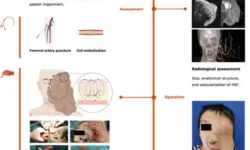 proryvnaya tehnika ligirovaniya ot chzhichao vana uspeshno udalyaet slozhnye pnf opuholi-ul-rks-ru-0