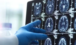 Гемотест делится важными уроками о деменции после новостей о Брюсе Уиллисе gemotest delitsya vazhnymi urokami o demenczii posle novostej o bryuse uillise-ul-rks-ru-0