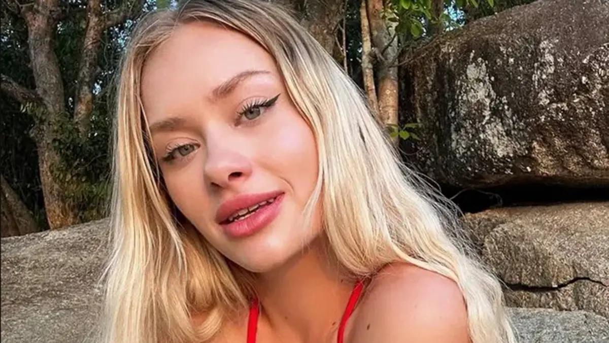 Покалеченная в Дубае украинская модель показала шрам на пол-лица