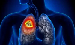 Исследование Рокфеллеровского университета о глутатионе и метастазах рака молочной железы issledovanie rokfellerovskogo universiteta o glutatione i metastazah raka molochnoj zhelezy-ul-rks-ru-0