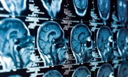 novye otkrytiya o vliyanii izmenenij entorinalnoj kory na bolezn alczgejmera sdelany kalifornijskim universitetom v irvajne i universitetom lalaguna-ul-rks-ru-0