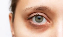 Россиянин год носил осколок снайперской пули в глазу после боёв на Украине rossiyanin god nosil oskolok snajperskoj puli v glazu posle boyov na ukraine-ul-rks-ru-0