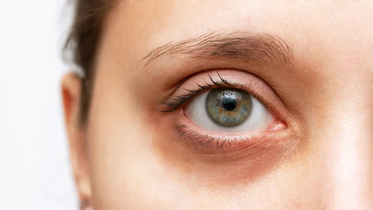 Baza: Россиянин год проходил с осколком снайперской пули в глазу