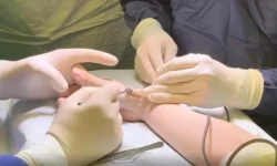 Инновации НМИЦ им. Турнера и Минобрнауки РФ в лечении детских переломов innovaczii nmicz im turnera i minobrnauki rf v lechenii detskih perelomov-ul-rks-ru-0